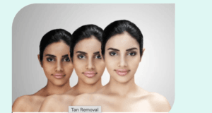Top Skin Clinic Near Me at Vanasthalipuram